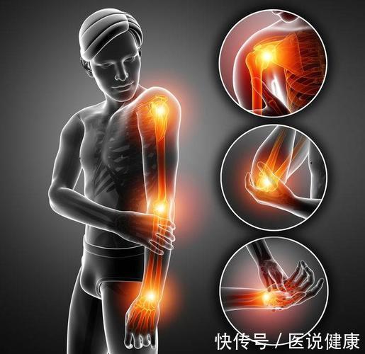 关节炎|手臂持续疼痛，别轻视，当心是这4种疾病已找上门，需及时检查
