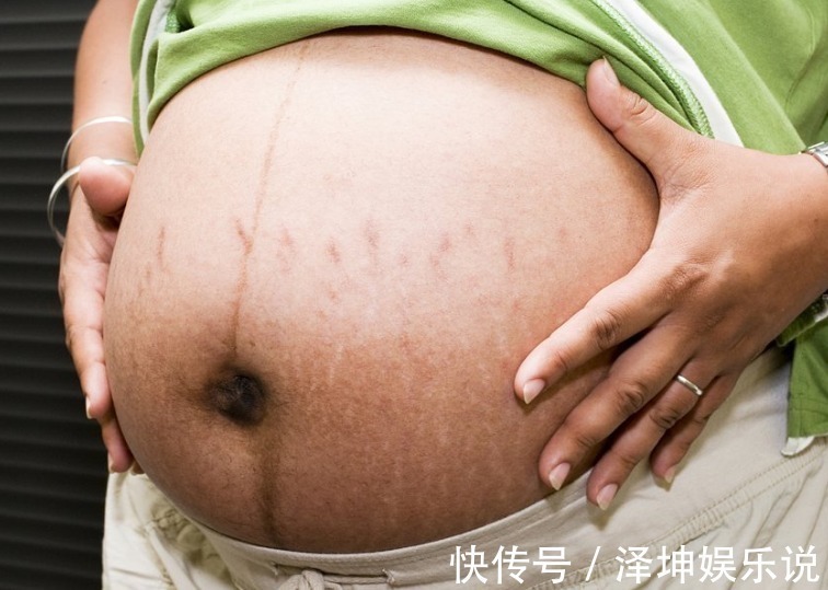 受精卵|怀了四胞胎,老公担心养不起,孕妇坚持生下,宝宝出生后乐开了花