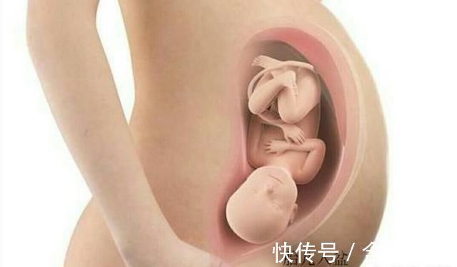 分娩|孕36周后，孕妈有这2种怪怪的“变化”，恭喜你，是胎儿入盆了