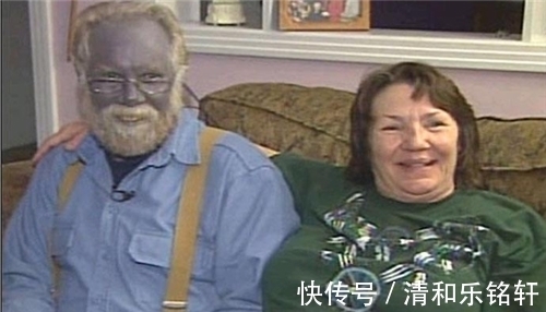 蓝色|地球上尊贵的蓝种人:隐居在6000米的山上,100多年仅露面了一次