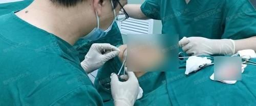 38岁做了眼周年轻化手术,看我眼周的变化,给计划做的人一个参考