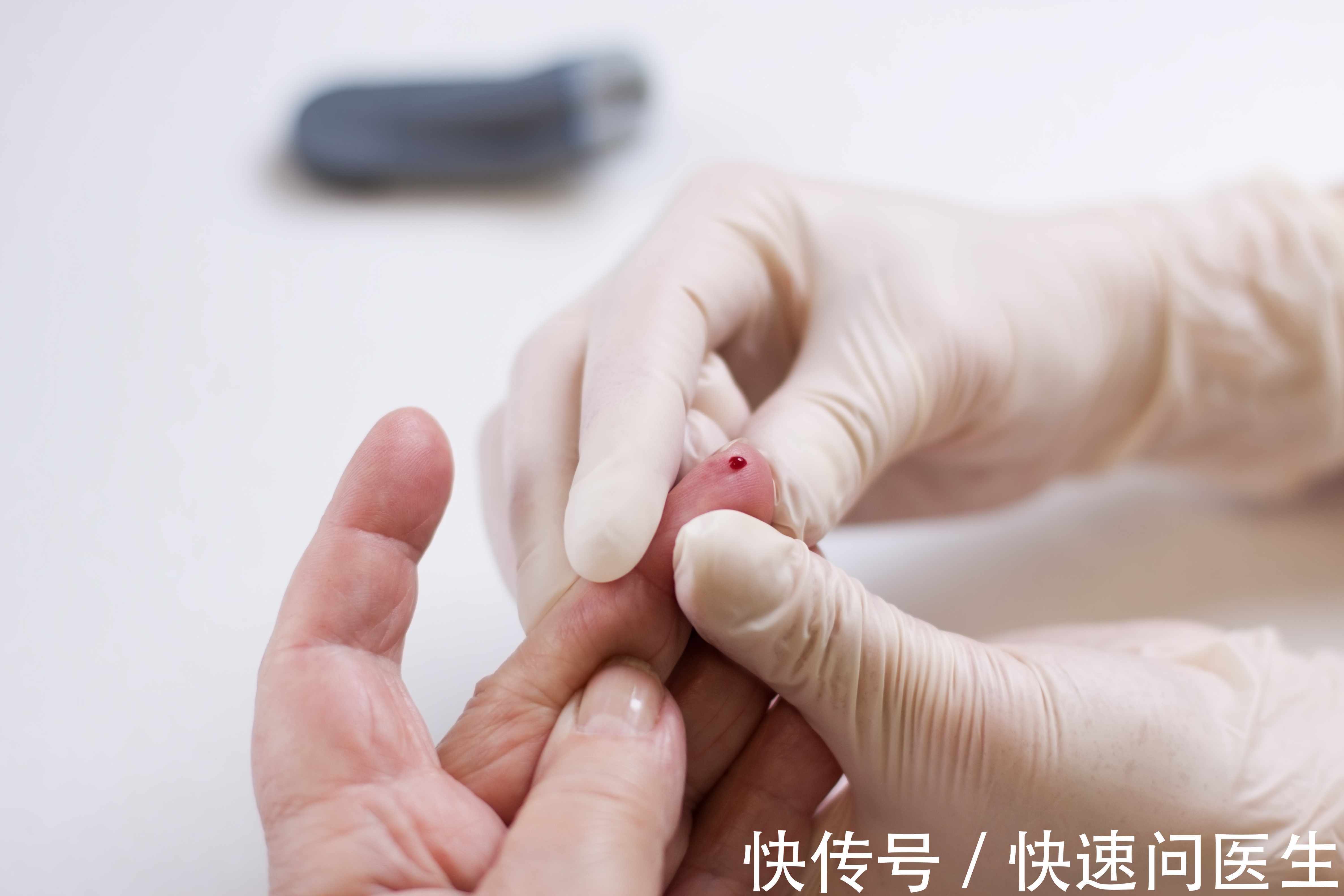 小便|糖尿病只是夜尿增多而已?糖尿病不用治疗?一文解析