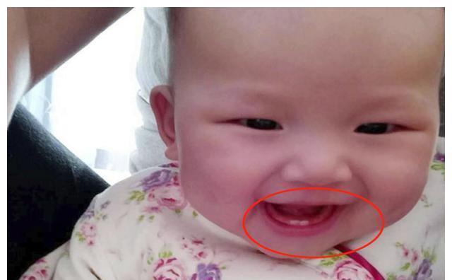 乳牙|宝宝几个月长牙正常？这份宝宝“乳牙萌发和护理表”，请家长收下