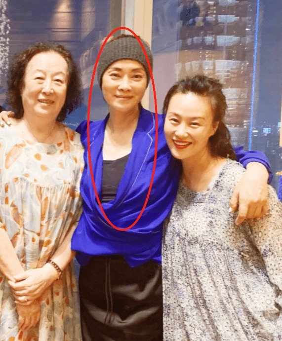 老太太|毛阿敏59岁真实不假,脸出油皮肤焉瘪,就是个普通老太太