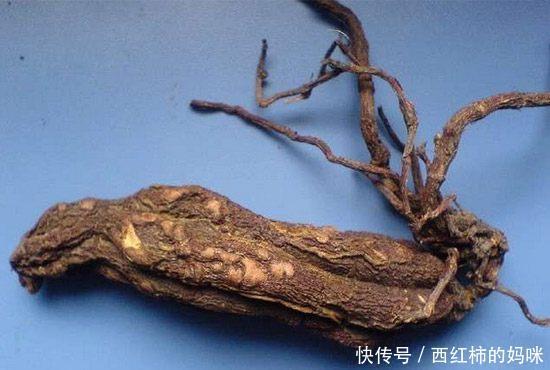 枸杞子|血糖不好管不住嘴?医生:这10种食物,不仅好吃还能降血糖