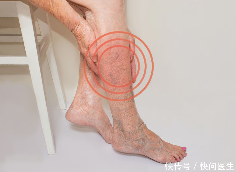 体内有栓,腿先知!提醒:腿部若有这3个表现,提示血管变窄了