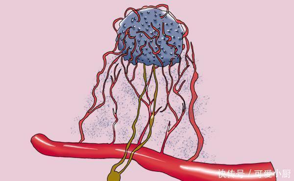 癌细胞|肿瘤医生：得癌后，先别灰心，做对5件事，有利于带瘤生存