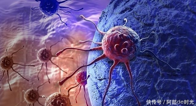 患癌|王女士一家相继“患癌”,原因可能是厨房里“1物”