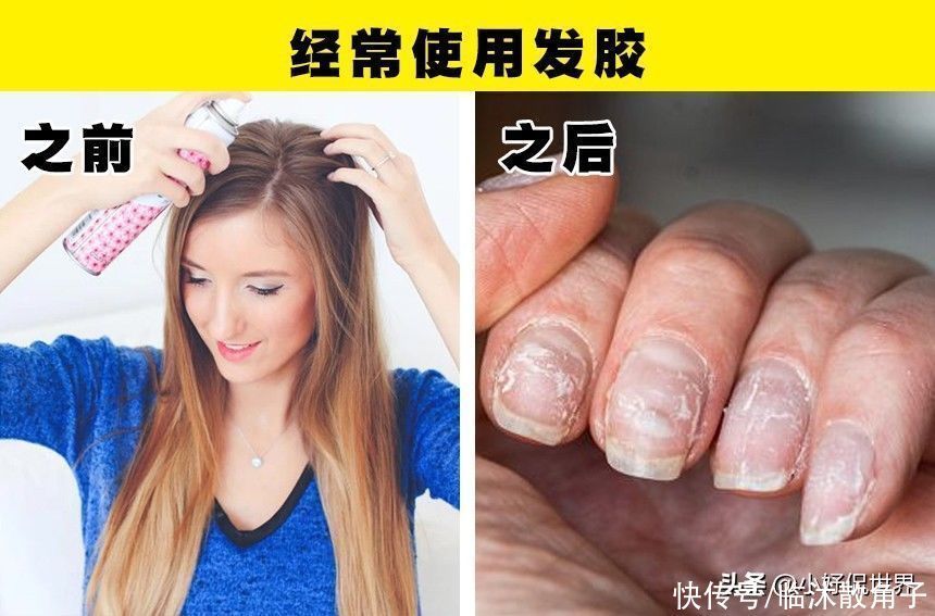 指甲油|在日常生活中,可能会对指甲产生破坏的7种习惯