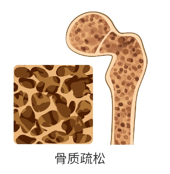 健康|三减三健之三健：口腔、体重和骨骼，健康三健不能忘！