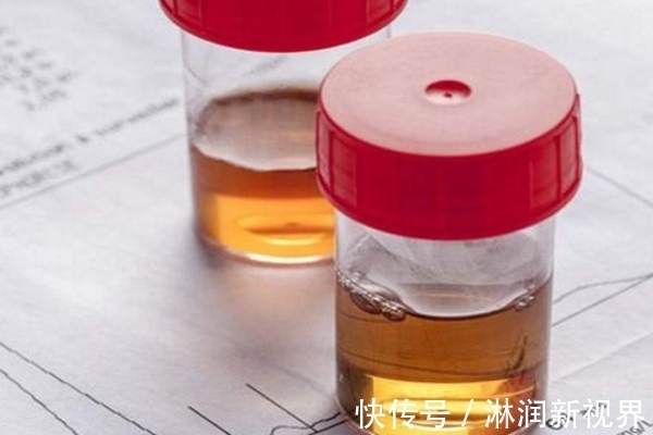 子宫|女人早起第一泡尿,若没有2个表现,那么恭喜你身体还很健康!