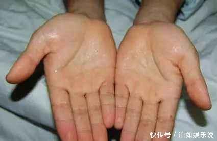 無(wú)論男女，汗從哪里來(lái)，病也跟著來(lái)，夏天愛(ài)出汗的人，別太晚看到