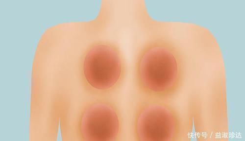 百病|肝气郁结惹百病，送你软坚散结法，疏肝理气化除结节