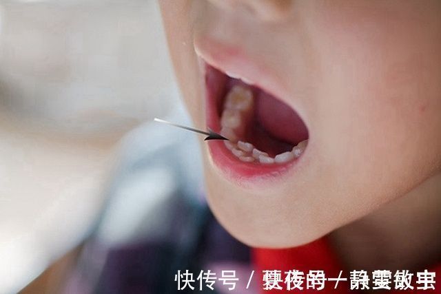 牙齿|孩子长出“双排牙”太难看？是乳牙脱落太晚导致的，需要适当刺激