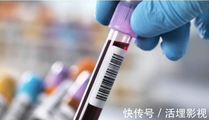 超标|大妈血脂从6.4降至1.6，医生：2物是血液“净化器”，可敞开吃