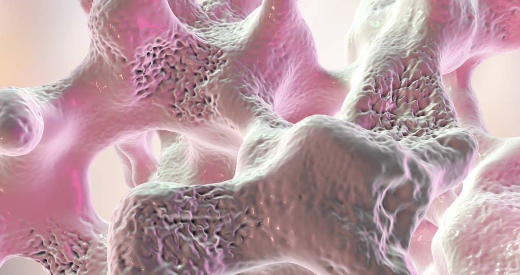 钙质|骨科医生:人过60,就怕骨折!吃什么能护骨?不喜欢也要多吃