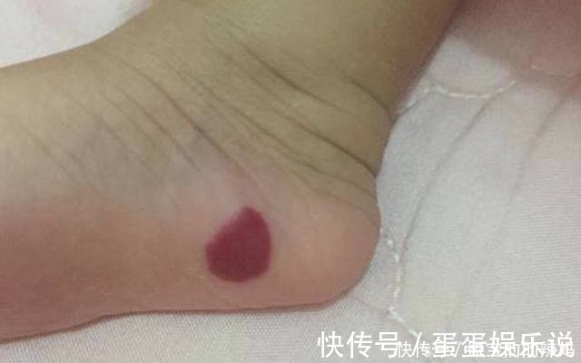 宝宝|宝妈以为新生宝宝身上的是朱砂痣,被网友着急评论:赶紧送医院
