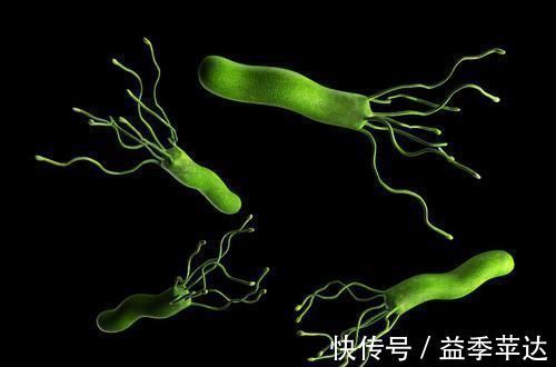 胃反酸|胃部的洗洁精找到了,不是大蒜,经常吃点,幽门螺杆菌全消失