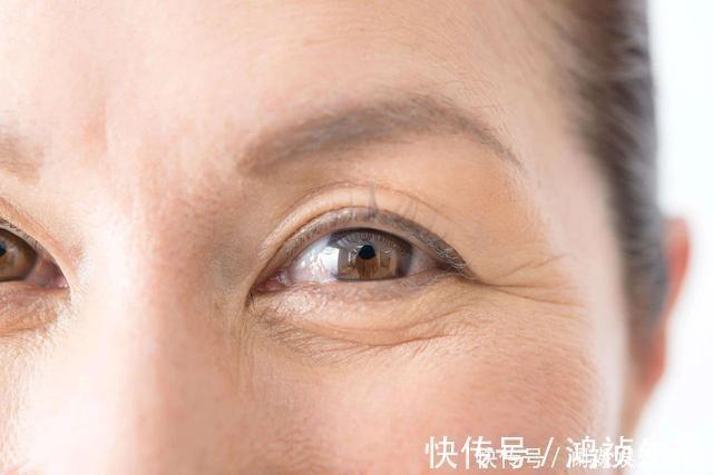 鱼尾纹|女性开始衰老的标志：1处变圆，2处变长，若都不占，说明还年轻