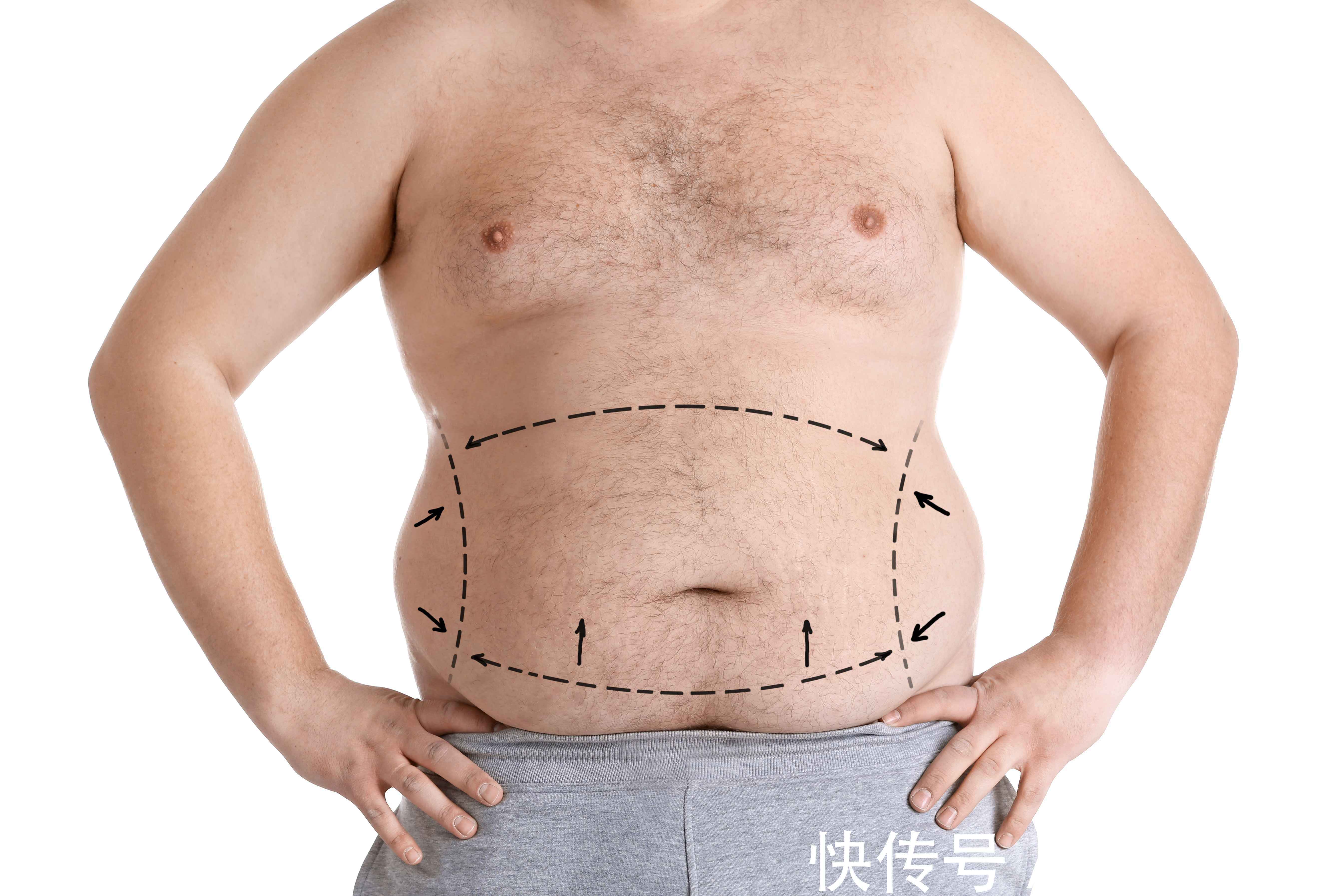 诱发|胰腺癌发作或3个因素脱不了关系,避免被胰腺癌缠上,做好这4件事