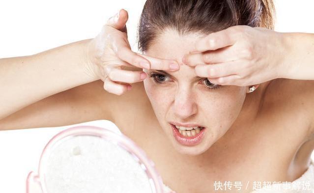 毛孔|爱长“闭口粉刺”的女生,每天坚持做这件事,皮肤白白净净又细腻