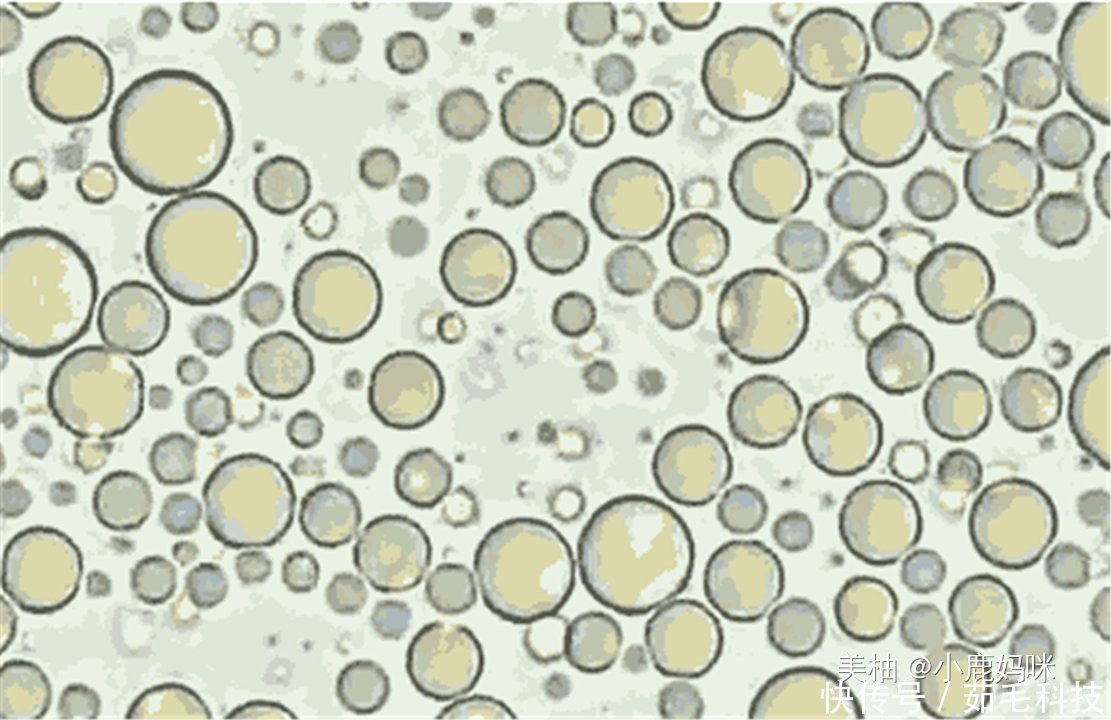 添加剂|将母乳放大1000倍是什么样显微镜下的图片,当妈的都该看看