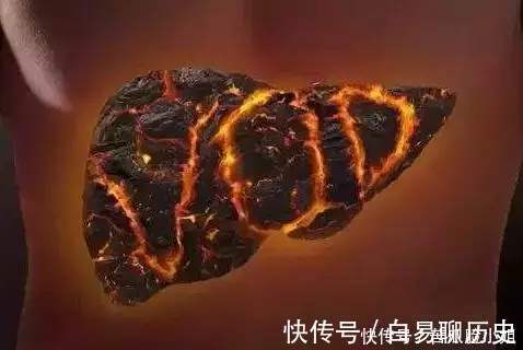 文君然|最受认可的“去肝火”小方子专治春天肝火大、爱郁闷,请学习