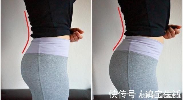 中立|“翘屁股”,我们真的需要它吗骨盆前倾危害大,9个动作纠正它