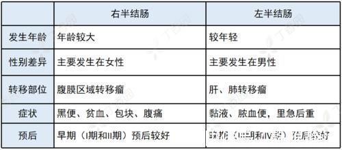 左半结肠癌|左半结肠癌 vs.右半结肠癌，这 4 大差异，你能答全吗？