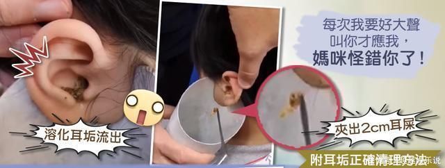 棉花棒|粗心妈妈以为孩子反应迟钝原来是耳垢填满耳朵,导致孩子听不到