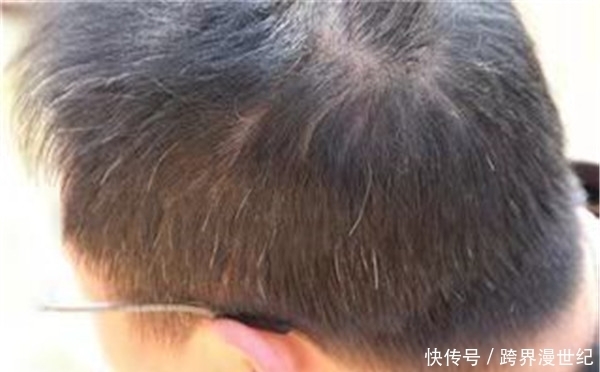 现了问题|养肝就是养命,肝不好会有4点表现,如果没有说明肝是健康的