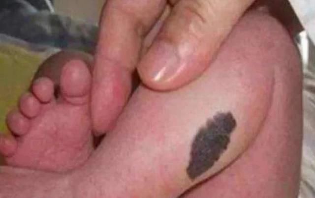 诱人|孕妈在孕期,尽量不做4件事,避免宝宝脸上长胎记,孕妈别不在意