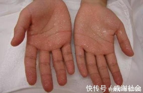 一日三餐|“脾胃虚”的宝宝,身上这2个部位经常出汗,父母早了解娃早受益