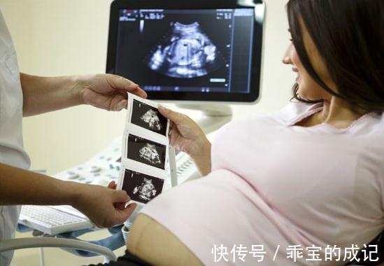 小女孩|无意中发现朋友的孩子是“唐氏儿”,该怎么告诉她?