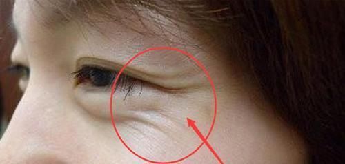 食物|女人这3个部位“大”，说明开始衰老了，吃这些食物滋补防衰