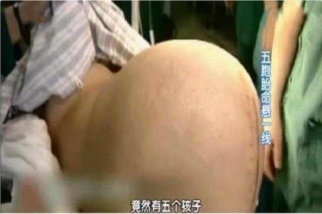 中国人|18年过去了,国内首例成功出生的5胞胎家庭,如今过得咋样了?