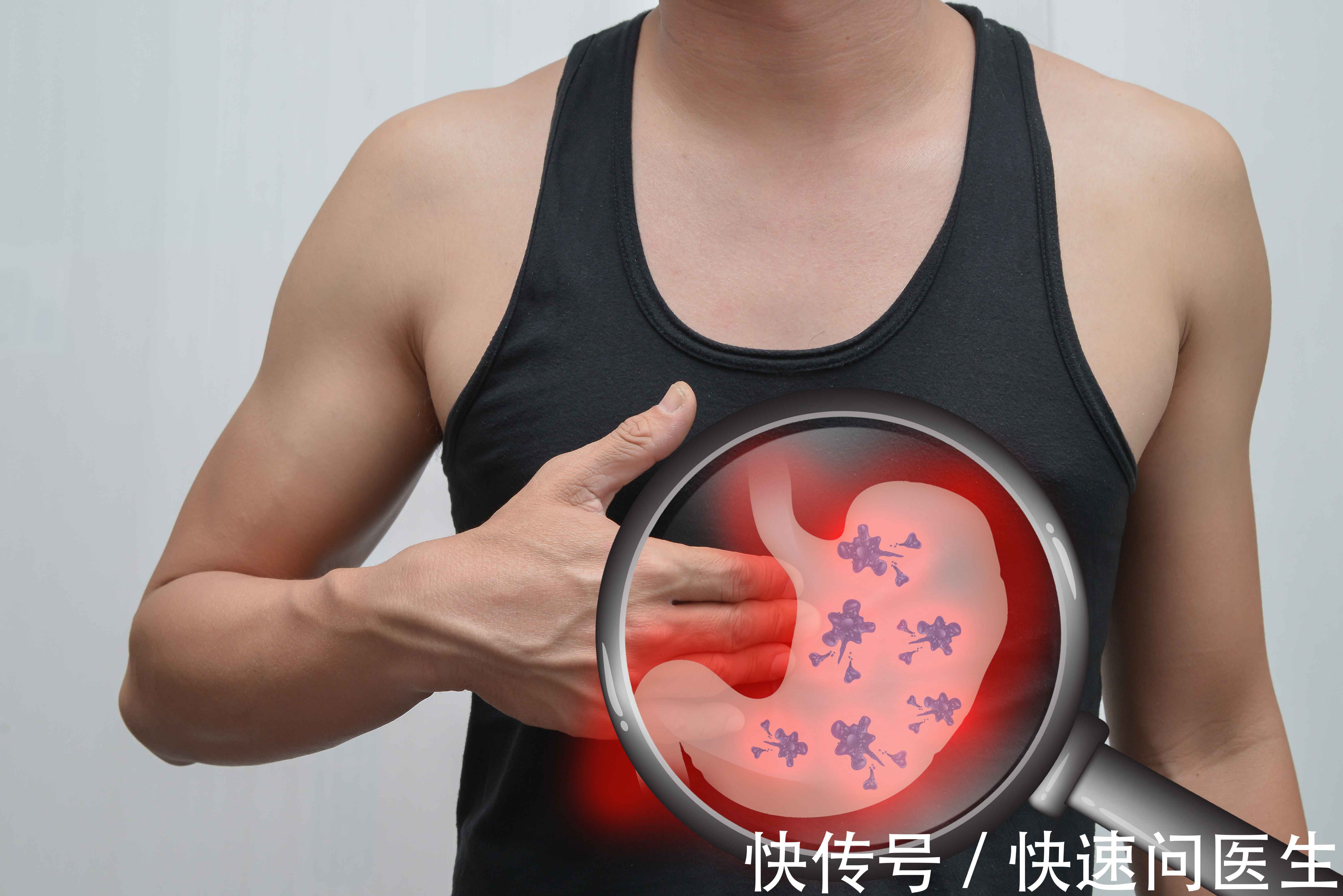 癌变|人人都有患癌的可能性,但并非人人都会患癌,4类人是赢家