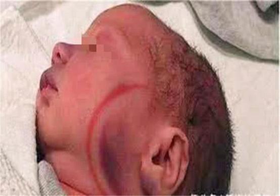 网红|“丑哭宝妈”的网红宝宝巨大变化,当初嫌我丑,如今美到认不出