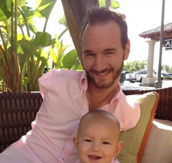 尼克|90后孕妇生下“海豹胎”,曾拒绝医生打掉,如今杂戏团要高价收购