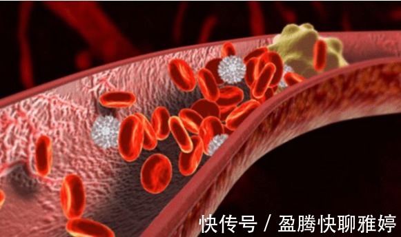 血管|高血脂的“稀释剂”被找到,柠檬未上榜,不妨多吃,血管或能畅通