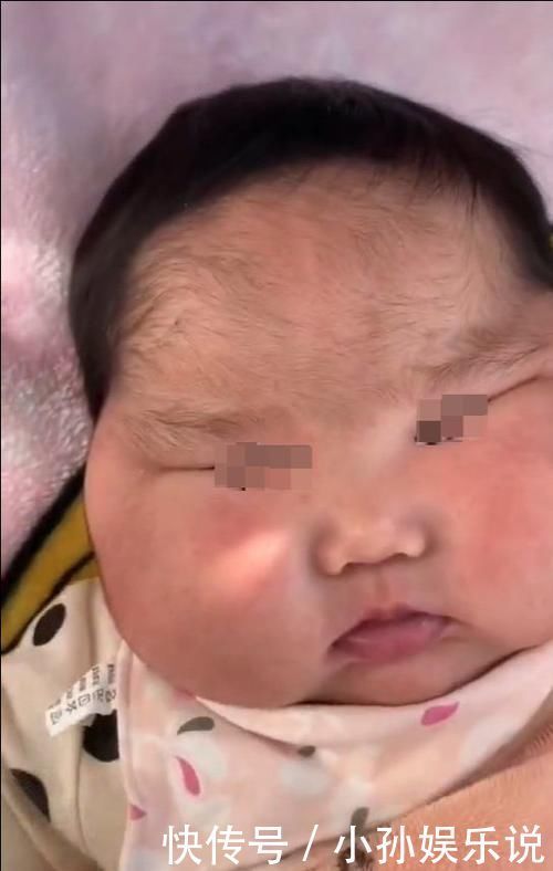 剂量|惊人反转?宝宝被大剂量涂抹面霜?大头娃娃父母被质疑了!