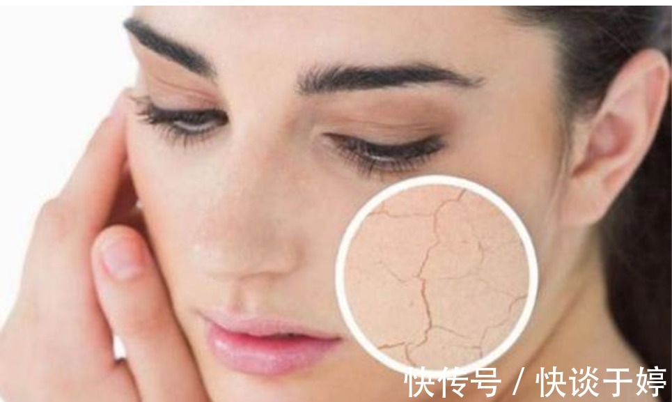 肌肤|肌肤屏障受损,多数因为护肤习惯差!