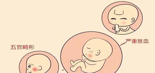 孕期|孕期胎儿畸形没有那么容易,孕妈做好这3点,胎宝宝会健康的出生