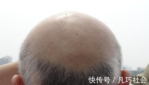 年龄|男人老没老,别只看年龄,身上有这些特征,应该要服老了