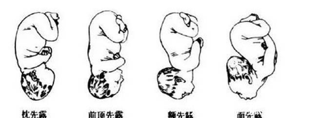 地方|育儿说:怀孕7个月宝宝是在什么位置的?从这些地方能够看出来