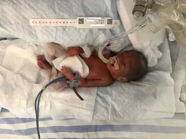 体重|100多天,我和弟弟在小箱子里“长出”了肺