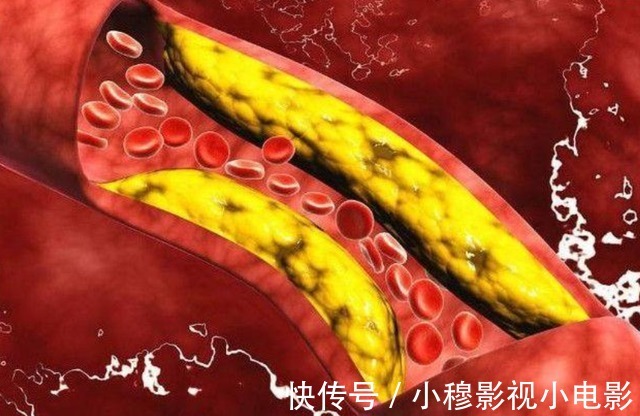 高血压病|今年新血压标准公布，不再是120/80，或许你的血压并不高