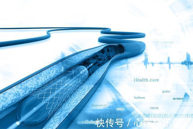 支架|做了心脏支架，病人就活不久了？实话实说，6类人群不适合做