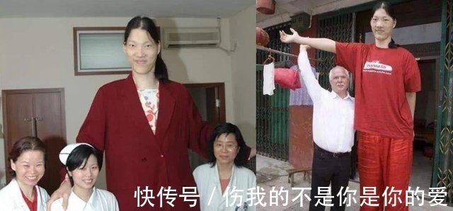 秋叶飘零|安徽''女巨人'',身高2.4米,穿78码的鞋,41岁离世留下4个心愿