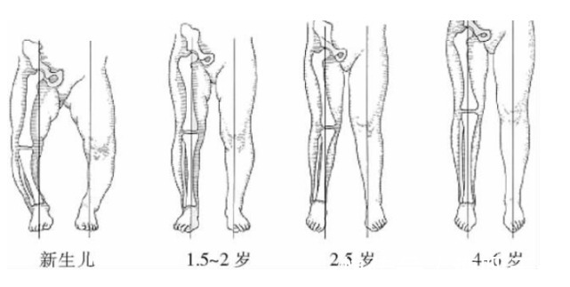 孩子|天使科普：孩子站早了，腿会不会变形？